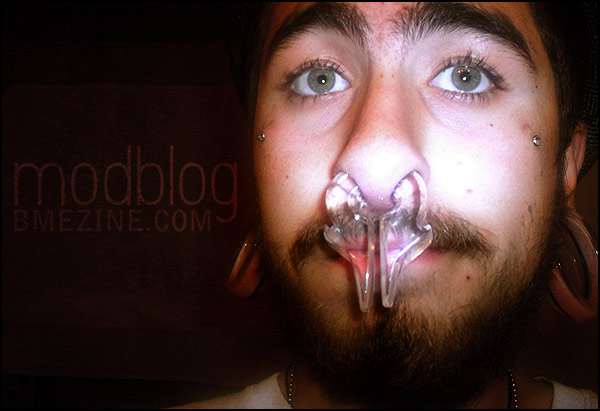 stuck-septum.jpg