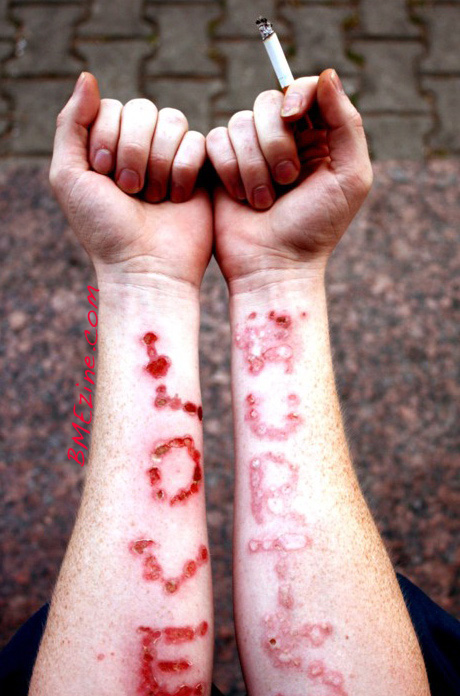 fzya-love-hurts-literally-copy