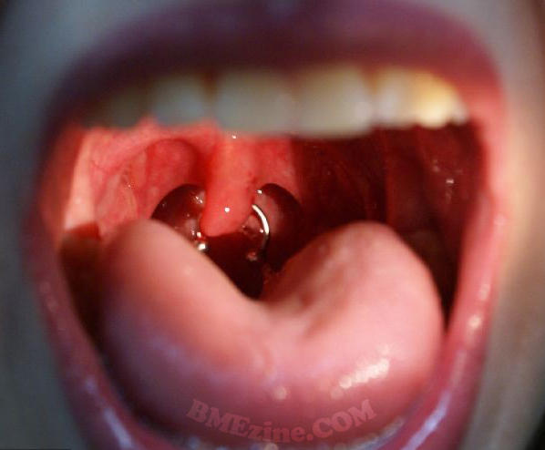 uvula uvula